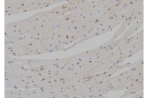 ABIN6258115 and ABIN6274297 at 1/100 staining Mouse heart tissue by IHC-P. (DLX5 抗体  (Internal Region))