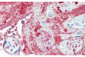 Detection of TPOR in Human Placenta Tissue using Polyclonal Antibody to Thrombopoietin Receptor (TPOR) (MPL 抗体  (AA 66-260))