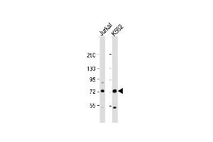 All lanes : Anti-PRMT5 Antibody (N-term) at 1:1000 dilution Lane 1: Jurkat whole cell lysate Lane 2: K562 whole cell lysate Lysates/proteins at 20 μg per lane. (PRMT5 抗体  (N-Term))