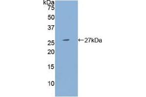Western blot analysis of recombinant Human PSG1. (PSG1 抗体  (AA 202-401))