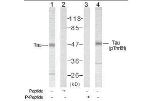 Image no. 1 for anti-Microtubule-Associated Protein tau (MAPT) (Thr181) antibody (ABIN197263) (MAPT 抗体  (Thr181))