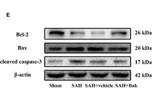 The effects of Bak on cellular apoptosis and neuronal degeneration following SAH. (beta Actin 抗体  (AA 1-375))