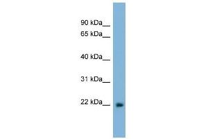 LBX2 antibody used at 0. (LBX2 抗体  (Middle Region))