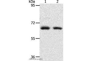 Western blot analysis of Human fetal kidney and fetal lung tissue, using ACOT11 Polyclonal Antibody at dilution of 1:450 (ACOT11 抗体)