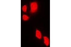 Immunofluorescent analysis of JAK2 staining in Jurkat cells. (JAK2 抗体)