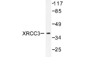 Image no. 2 for anti-X-Ray Repair Complementing Defective Repair in Chinese Hamster Cells 3 (XRCC3) antibody (ABIN271981) (XRCC3 抗体)