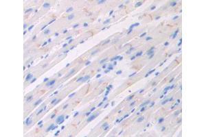 Used in DAB staining on fromalin fixed paraffin- embedded heart tissue (FLRT2 抗体  (AA 300-517))