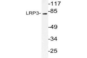 Western blot (WB) analysis of LRP3 antibody in extracts from RAW264. (LRP3 抗体)