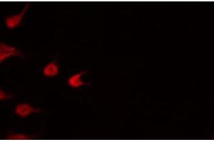 Immunofluorescence (fixed cells) (IF/ICC) image for anti-Nuclear Factor of kappa Light Polypeptide Gene Enhancer in B-Cells 2 (NFKB2) (pSer866) antibody (ABIN6256439)