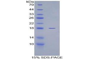 SDS-PAGE of Protein Standard from the Kit (Highly purified E. (IL-6 Receptor ELISA 试剂盒)