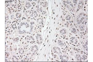 Immunohistochemical staining of paraffin-embedded breast tissue using anti-USP13 mouse monoclonal antibody. (USP13 抗体)