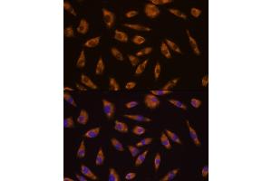 Immunofluorescence analysis of L929 cells using GLP1R antibody (ABIN6131006, ABIN6141138, ABIN6141140 and ABIN6224643) at dilution of 1:100. (GLP1R 抗体  (AA 22-116))