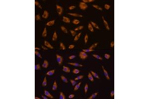 Immunofluorescence analysis of L929 cells using GLP1R antibody (ABIN6131006, ABIN6141138, ABIN6141140 and ABIN6224643) at dilution of 1:100. (GLP1R 抗体  (AA 22-116))