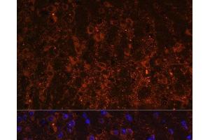 Immunofluorescence analysis of Mouse brain using SNX13 Polyclonal Antibody at dilution of 1:100. (SNX13 抗体)