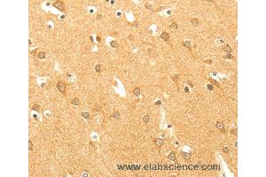 Immunohistochemistry of Human brain  using AARS2 Polyclonal Antibody at dilution of 1:40 (AARS2 抗体)