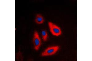 Immunofluorescent analysis of Galactose Kinase staining in HepG2 cells. (GALK1 抗体  (N-Term))