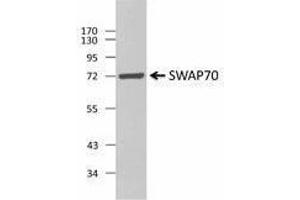 Western Blotting (WB) image for anti-SWAP Switching B-Cell Complex 70kDa Subunit (SWAP70) antibody (ABIN2666297) (SWAP70 抗体)
