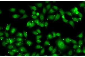 Immunofluorescence analysis of MCF7 cells using NR2C1 Polyclonal Antibody (NR2C1 抗体)