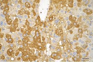 Immunohistochemistry was performed on paraffin-embedded mouse liver using AGL antibody (ABIN7797592), 1:200). (Recombinant AGL 抗体)