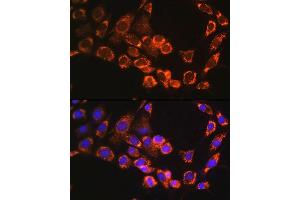 Immunofluorescence analysis of NIH/3T3 cells using TRIM23 Rabbit pAb (ABIN6131175, ABIN6149508, ABIN6149509 and ABIN6224352) at dilution of 1:100. (TRIM23 抗体  (AA 1-280))