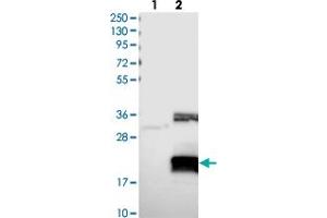 Western blot analysis of Lane 1: Negative control (vector only transfected HEK293T lysate), Lane 2: Over-expression Lysate (Co-expressed with a C-terminal myc-DDK tag (~3. (CHTOP 抗体)