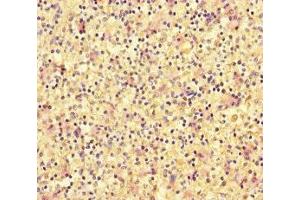 Immunohistochemistry of paraffin-embedded human spleen tissue using ABIN7150566 at dilution of 1:100 (DOK2 抗体  (AA 123-412))