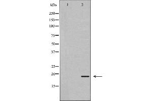 Western blot analysis of extracts of mouse kidney tissue , using REG3G antibody. (REG3g 抗体)