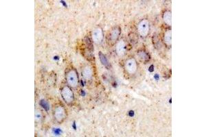 Immunohistochemical analysis of IGF2BP3 staining in mouse brain formalin fixed paraffin embedded tissue section. (IGF2BP3 抗体)