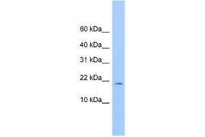 C10ORF83 antibody used at 1 ug/ml to detect target protein. (MORN4 抗体  (Middle Region))