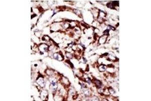 Image no. 1 for anti-Palmitoyl-Protein Thioesterase 1 (PPT1) (C-Term) antibody (ABIN357784) (PPT1 抗体  (C-Term))