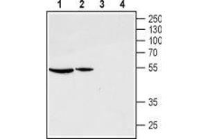 Western blot analysis of rat ovary (lanes 1 and 3) and pituitary (lanes 2 and 4) lysates: - 1,2. (GNRHR 抗体  (Extracellular, N-Term))