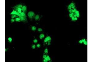 Anti-CHN1 mouse monoclonal antibody (ABIN2455946) immunofluorescent staining of COS7 cells transiently transfected by pCMV6-ENTRY CHN1 (RC222163). (CHN1 抗体)