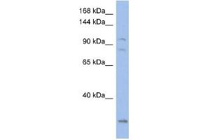 WB Suggested Anti-KCNQ5 Antibody Titration:  0. (KCNQ5 抗体  (Middle Region))
