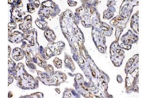 IHC analysis of VEGF Receptor 3 using anti-VEGF Receptor 3 antibody . (FLT4 抗体)
