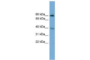 WB Suggested Anti-L3mbtl Antibody Titration: 0. (L3MBTL1 抗体  (Middle Region))