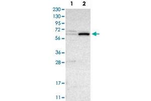 Western Blot analysis of Lane 1: RT-4 and Lane 2: U-251 MG sp cell lysates with CRAT polyclonal antibody . (CRAT 抗体)