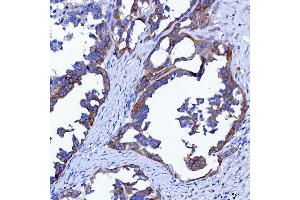 IHC analysis of SWAP70 using anti-SWAP70 antibody (ABIN7600201). (SWAP70 抗体  (AA 161-292))