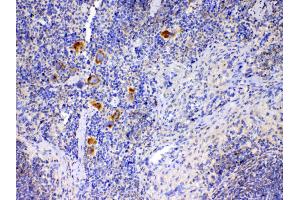 IHC analysis of IL12A using anti-IL12A antibody . (IL12A 抗体  (AA 23-215))
