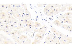 Detection of GSTA4 in Human Cardiac Muscle Tissue using Polyclonal Antibody to Glutathione S Transferase A4 (GSTA4) (GSTA4 抗体  (AA 3-222))
