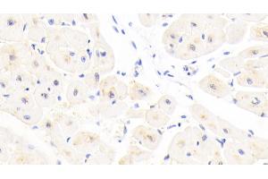 Detection of GSTA4 in Human Cardiac Muscle Tissue using Polyclonal Antibody to Glutathione S Transferase A4 (GSTA4) (GSTA4 抗体  (AA 3-222))