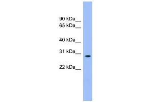 WB Suggested Anti-ENOPH1 Antibody Titration: 0. (MASA 抗体  (N-Term))