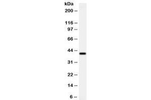 Western blot testing of human MCF7 cell lysate with ADK antibody at 0.