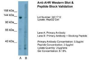 Host:  Rabbit  Target Name:  AHR  Sample Type:  HepG2  Lane A:  Primary Antibody  Lane B:  Primary Antibody + Blocking Peptide  Primary Antibody Concentration:  5. (Aryl Hydrocarbon Receptor 抗体  (N-Term))