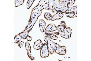 IHC analysis of RING2/RING1B/RNF2 using anti-RING2/RING1B/RNF2 antibody (ABIN7599286).