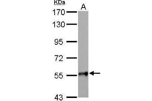 WB Image GALNT2 antibody detects GALNT2 protein by Western blot analysis. (GALNT2 抗体)