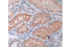 Used in DAB staining on fromalin fixed paraffin- embedded Kidney tissue