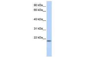 FLJ33706 antibody used at 5 ug/ml to detect target protein. (FLJ33706 (C-Term) 抗体)