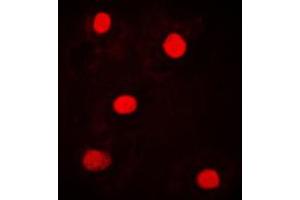Immunofluorescent analysis of NICE4 staining in MCF7 cells. (UBAP2L 抗体  (Center))