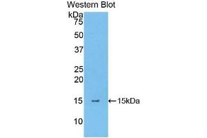 Western blot analysis of the recombinant protein. (Thymic Stromal Lymphopoietin 抗体  (AA 75-196))