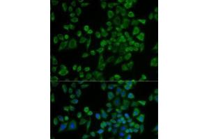 Immunofluorescence analysis of U2OS cells using P2RY2 Polyclonal Antibody (P2RY2 抗体)